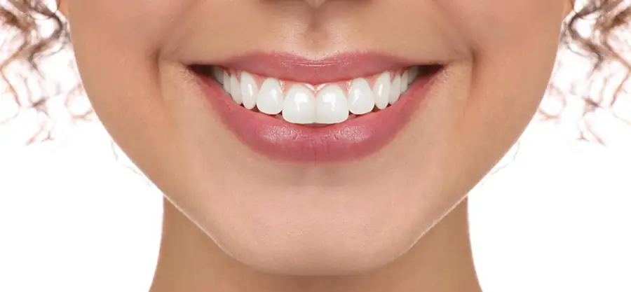 After treatment, case 2