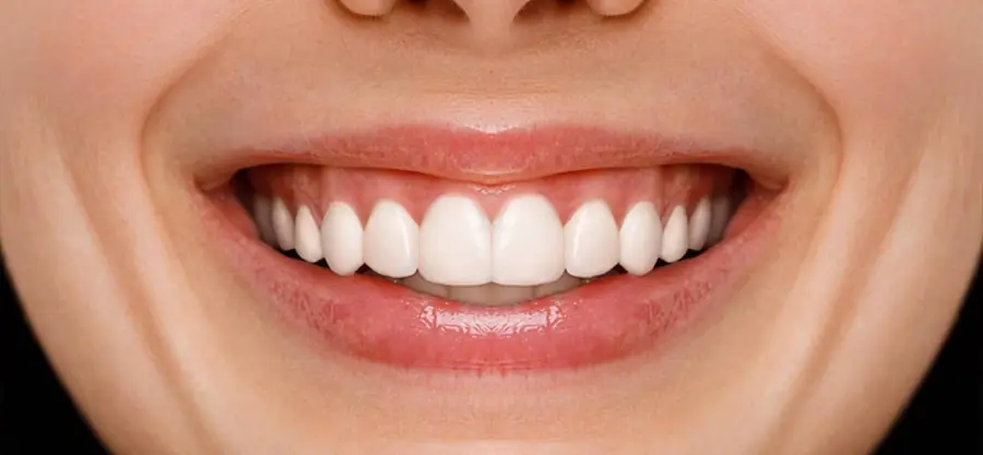 After treatment, case 3