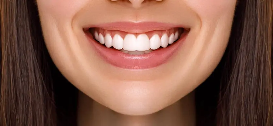 After treatment, case 4