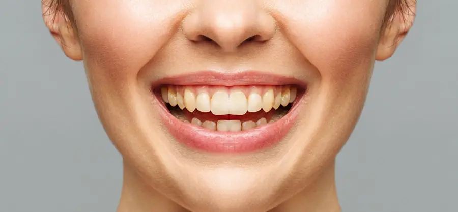 Before treatment, case 1