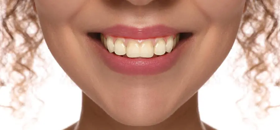 Before treatment, case 2