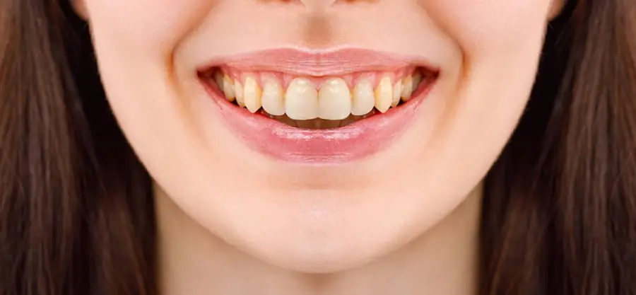 Before treatment, case 4