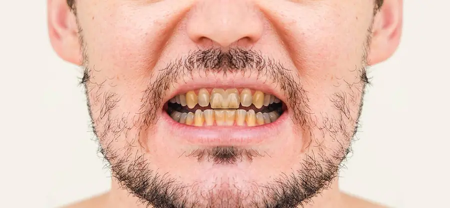 Before treatment, case 5