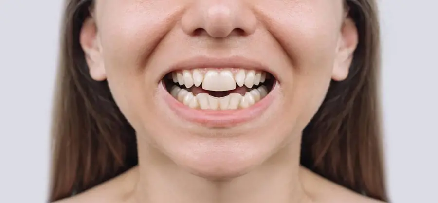 Before treatment, case 6